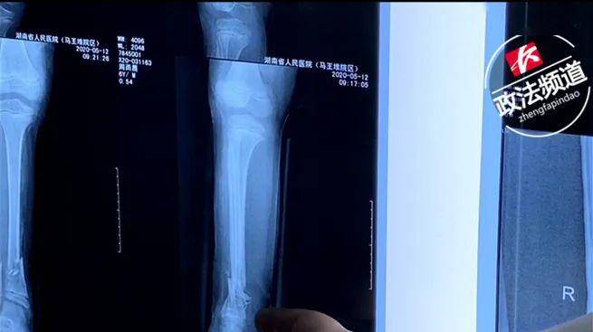 冰山上的来客 相关产品