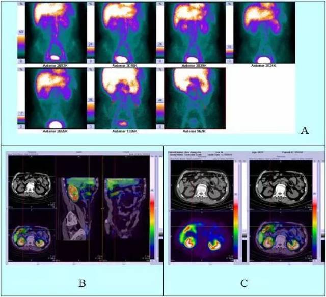 冷酷的心 相关产品