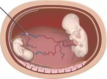 你好，再见 相关产品