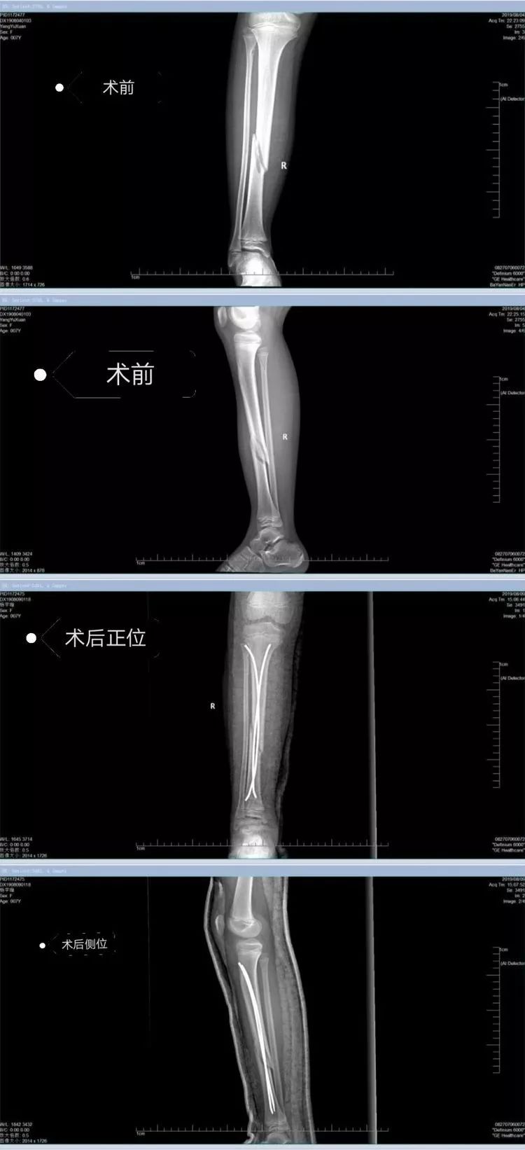 冰肤传说 推荐产品