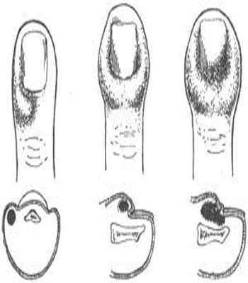 侥幸逃生的司机 产品图片